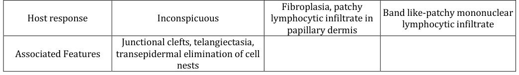 Figure 12: Spitz nevus with atypical epitheloid and spindle cell nests with nuclear and cellular pleomorphism and nuclear hyperchromasia [15].