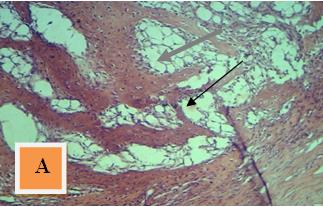 Figure 18