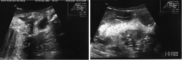 Figure 1: Ultrasonography.