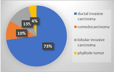 Figure 4: Distribution of patients by histological type (n=48).