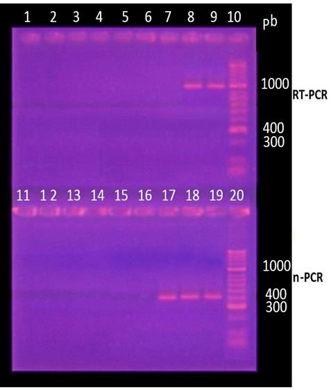 Figure 1: Detection of the phosphoprotein gene by RT-PCR. Visualization of products amplified by nested RT-PCR by electrophoresis in 2% agarose gel in TAE buffer and subsequent incubation in ethidium bromide. Lanes 1, 2, 11 and 12: control of reagents (nuclease-free water duplicates). Lane 3, 4, 13, 14: negative control (uninfected dog, duplicate); Lane 5.6, 15.16: Control of reagents. Lane 7, 17: Snyder Hill Strain (Vanguard Plus 5 / L4 CV). Lane 8, 18: Lederle strain (Canigen®MHA2PPi / L). Lane 9 and 19: Ondersterpoort strain (Nobivac®Puppy DP). Lane 10 and 20: MM, molecular size marker (50-2000 bp, Bioline ®).