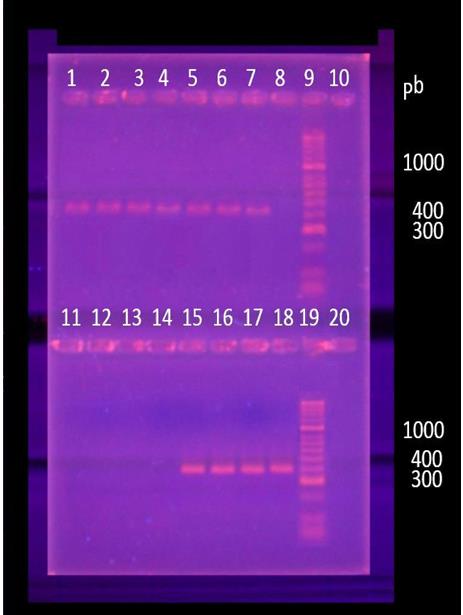 Figure 3: Detection of the phosphoprotein gene by nested RT-PCR. Visualization of products amplified by nested RT- PCR by electrophoresis in 2% agarose gel in TAE buffer and subsequent incubation in ethidium bromide. Lanes number 1 to 7 (canine 1 to 7 respectively according to table 2) and lanes 15, 16 and 17 (canine 8 to 10 respectively according to table 2) correspond to clinical samples analyzed previously for the hemagglutinin gene [19]. Lane 18 corresponds to the Snyder Hill strain (Vanguard Plus 5/L4 CV); lanes 8 and 11 correspond to reagent controls, while lane 12,13 and 14 (triplicate) correspond to negative control, dog not infected with the virus. Lanes 9 and 19 correspond to the molecular size marker (50-2000 bp, Bioline®). Lanes 10 and 20 do not contain sample