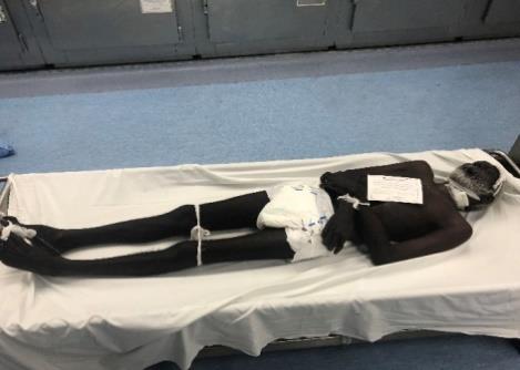 Figure 3: A fresh body.