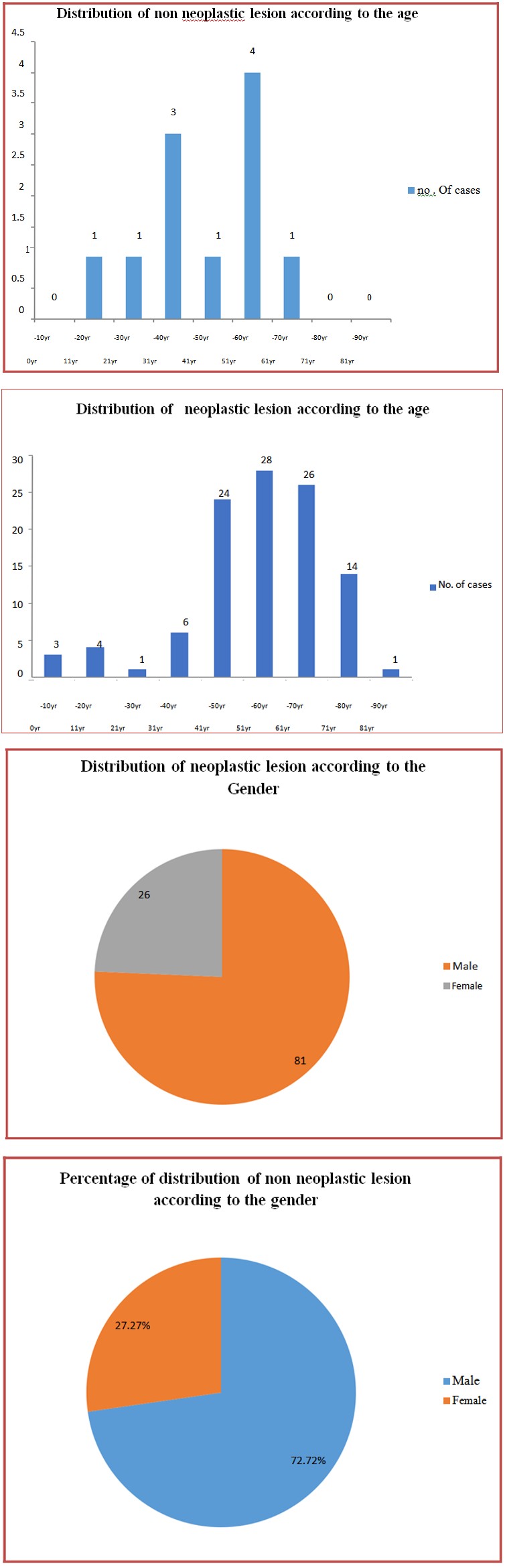 Figure 3: Trophozoites of E.histolytica in amebic liver abscess. Abscess: Pyogenic abscess showed a marked neutrophil infiltrate, with necrotic debris. Hepatocytes from the periphery of the abscess may show considerable atypia. The predominant organism in pyogenic abscesses is Klebsiella. Amebic abscess due to Entamoeba histolytica, with contents likened to anchovy paste (thick reddish- brown semi-fluid material), shows abundant necrosis with fewer inflammatory cells. Trophozoites are not found in the central necrotic area; they should be sought in the viable periphery of the abscess. They are globular organisms, with an eccentric spherical nucleus showing a central clear zone with a dot-like karyosome and margination of chromatin. The cytoplasm is vacuolated and contains ingested red blood cells. Amoebae stain positive with PAS. They resemble foamy macrophages and may be missed if not suspected.