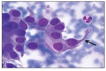 Figure 52: Irregular knobby border of 3D cell cluster- typical.