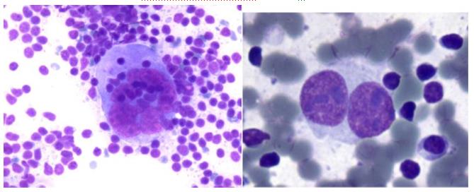 Figure 68: SLL vs LPCL.