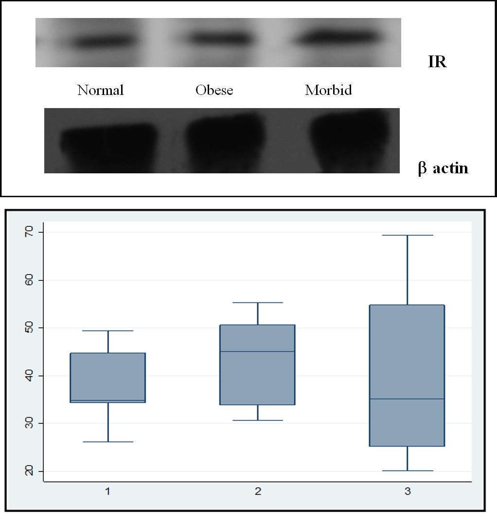 Figure 5: Expression of leptin receptor (LR) on the peripheral blood mononuclear cells (PBMC) was decreased in obese subjects. , pm,n = 0.009; po,n = 0.028 p < 0.05: Significant: n: Normal, o: Obese, m: Morbid obese.