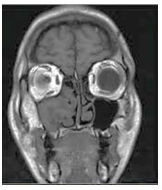 Figure 2: Patient preoperative.