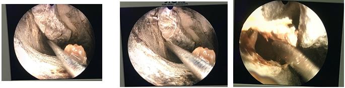 Figure 4: Steps of Intraoperative Management.