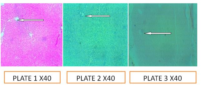 Figure 2: Plate1: Control; Plate 2: pH 5.0; Plate 3: pH: 7.5.