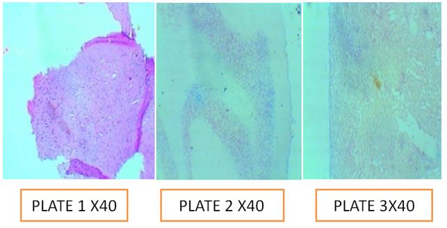 Figure 6: Plate1: Control; Plate 2: pH 5.0; Plate 3: pH 7.5.