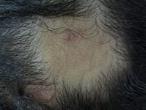 Figure 1: Trichophytic tinea due to _T. tonsurans._