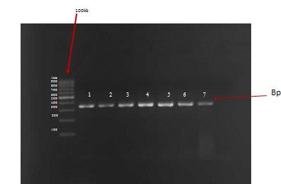 Figure 6: Identification of Lactobacillus species from genomics DNA of the two isolates (1-BKT, 2-PGUT).