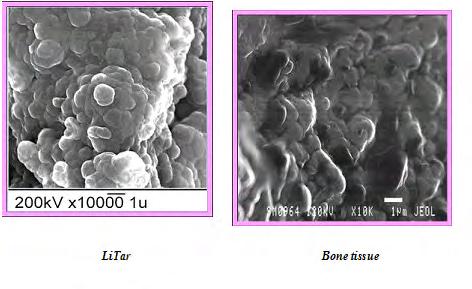 Figure 3: The average sizes of apatite crystals in the material LitAr (44 nm) and bone tissue (37 nm) have similar values: It is precisely because of this LitAr acts on the body potent cells, providing complete bone tissue regeneration in traumatology and orthopedics without any possible negative rejection.