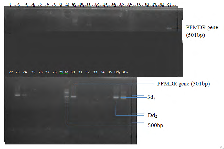 Figure 1: Gel electrophoresis showing the PFMDR gene of malaria parasites from HIV positive patients. Lanes without band represents the absence of PFMDR gene while those with bands indicate presence of the gene. Lane M represents the Quick- Load 100bp molecular ladder while Dd2 and 3d7 are the mutant and Wild type controls respectively.