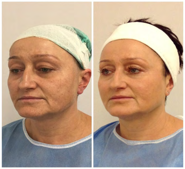 Figure 4: Patient age: 60.