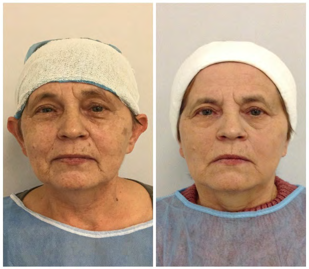 Figure 6: Patient age: 63.