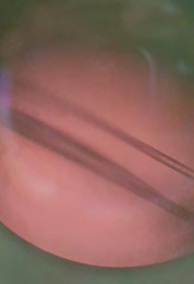 Figure 3: Polarized light showing an alternation of dark and light areas over their entire length.
