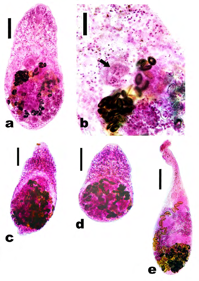 Figure 1: Adult heterophids recovered from necropsied cats. a Adult Heterophyes heterophyes. Scale bar = 100 μm. b Gonotyle (ventrogenital complex) (arrow) of adult Heterophyes heterophyes showing numerous rodlets (more than 70). Scale bar = 50 μm. c Adult Pygidiopsis summa. Scale bar = 100 μm. d Adult Procerovum varium. Scale bar = 100 μm. e Adult Ascocotyle longicollis. Scale bar = 100 μm.