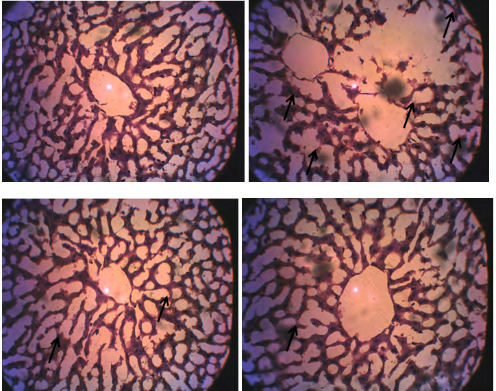 Figure 6: Photomicrograghs of section of hepatic tissues of rats administered Cypermethrin, vitamin C and E. A: control rats showing normal hepatic architecture, moderately arranged in a cord like manner radiating from the central vein and separated by an irregular and widen sinusoid B: rats administered cypermethrin only showing severe damage hepatic histo-architecture characterized by damage liver parenchyma and hepatocyte. The hepatocytes are scattered in the hepatic parenchyma instead of radiating in a cord arrangement from the central vein and are separated by a widening sinusoid. C: rats administered cypermethrin + Vitamin C showing moderately arranged in a cord like manner radiating from the central vein and separated by an irregular and widen sinusoid with mild degeneration of hepatocytes. D: rats administered cypermethrin + Vitamin E showing mild degeneration of hepatocytes