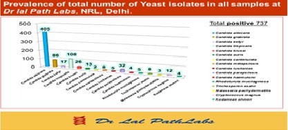 Figure 2: Total number and Percentage wise prevalence of positive fungal (yeast species) isolates from different type of samples.