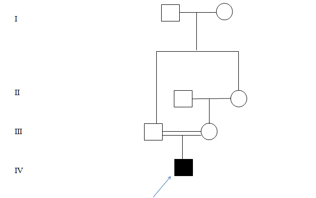 Figure 1: Showing pedigree of the baby affected with Leigh disease.