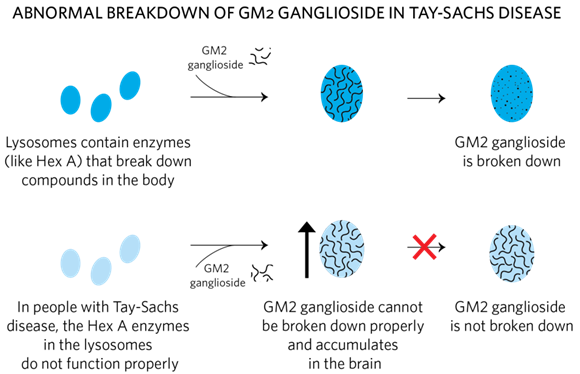 Figure 8: Schematic view of abnormal breakdown of GM2 ganglioside in Tay-Sachs disease.