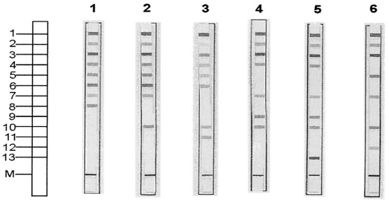 Figure 1: Results representative of all of the patterns obtained with the Genotype MTBC assay. The positions of the oligonucleotides and the marker line are shown on the left. The specificity and targetedgenes of the lines are as follows: 1, conjugate control; 2, plification control (23S rRNA); 3, MTBC specific (23S rRNA); 4 to 12, discriminative for the MTBC species (gyrB); 13, M. bovis BCG (RD1); M, marker line for correct orientation of the strip. Patterns of the strips shown: 1, M. tuberculosis or M. africanum subtype II or M. canetti. 2, M. africanum subtype I; 3, M. microti; 4, M. bovis subsp. bovis; 5, M. bovisBCG; 6, M. bovis subsp. Caprae (Adapted from Richter et al., 2003)