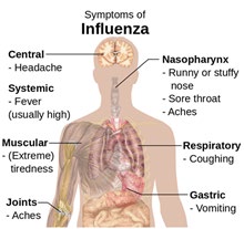 Figure 2: Symptoms of influenza, with fever and cough the most common symptoms [20-22].