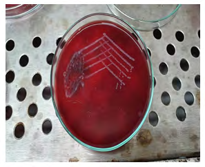 Figure 4: Blood agar showing grey moist swarming colonies of Proteus Mirabilis.