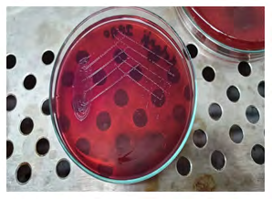 Figure 5: Macconkey agar showing pale non-lactose fermenting colonies.
