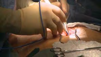 Figure 1: surgical procedure.