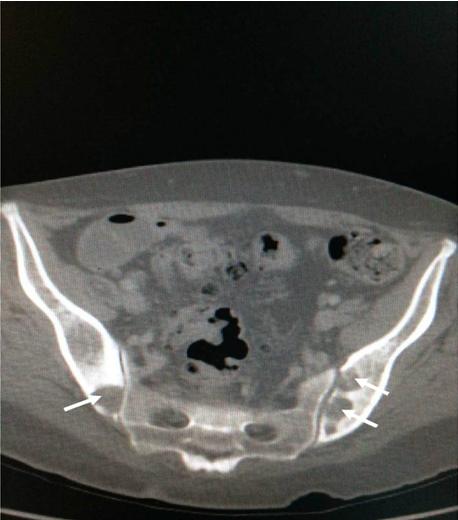 Figure 4: Contrast enhancing CT scan of the abdomen.