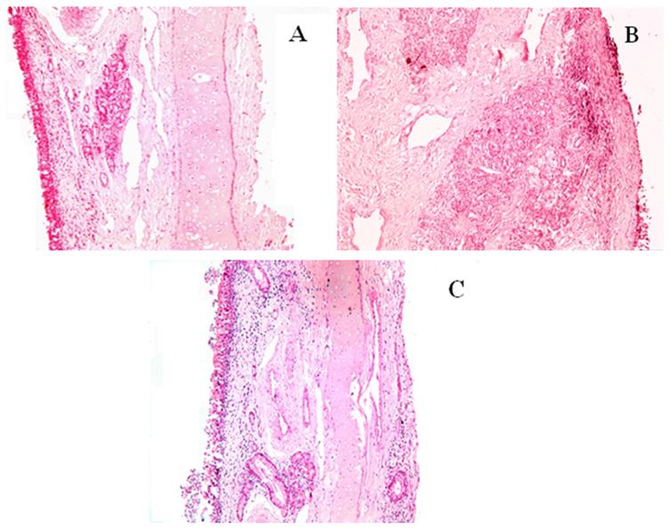 Figure 6: Photomicrographs of the Posterior Segments of Sheep Nasal Mucosa Treated with pH 6.4 PBS (negative control, A), Isopropyl alcohol (positive control, B) and CZ- Loaded Transferosomes (C) (100X).