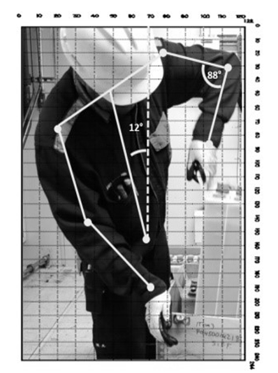 Figure 2: Forced exposure of the trunk.