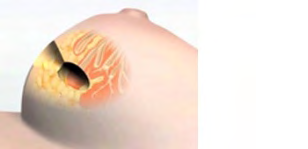 Figure 1: Image courtesy of Zeiss.
