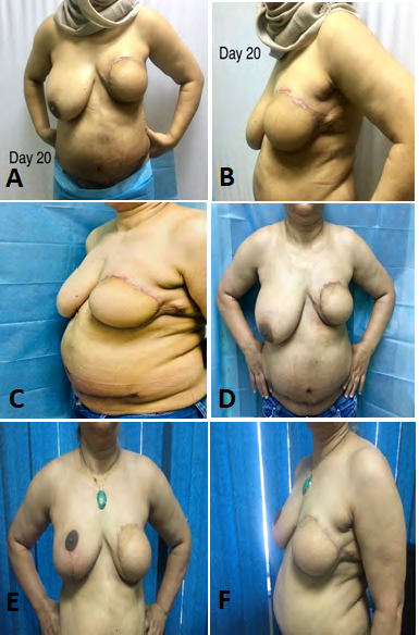 Figure 10