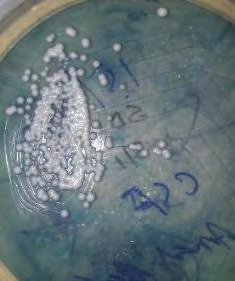 Figure 2: ** Cryptococcus isolated in SDA.