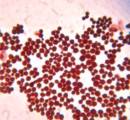 Figure 3: Gram stain of fungal culture.