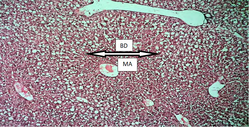 Figure 3: Cross histological section of liver tissue from castrated male mic showing Ballooning Degeneration (BD) and lipid accumulation in hepatocytes. Macro vesicular steatosis (MA) (X100).