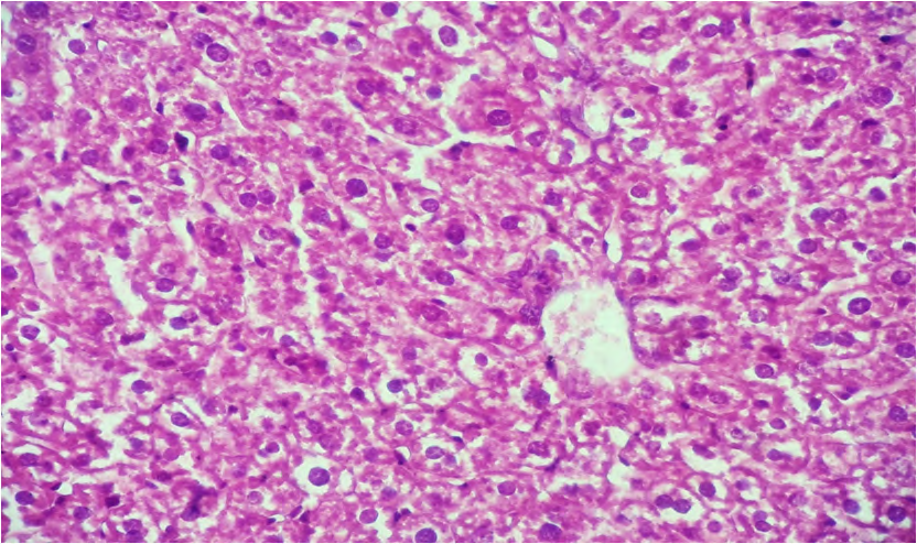 Figure 8: Cross histological section of liver tissue from castrated group treated with 10µl/g grape juice showing normal histological structure (X400).