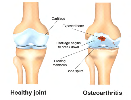 Figure 1: Joints.
