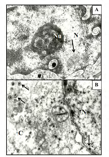 Figure 1: Electron micrograph of viruses. A) Nucleus inclu- sion of papilloma virus in crystalline arrangement in epi- dermal cell (arrows; 19,680X); B) Cytoplasmic and nucleus inclusions of Pseudorrabia virus in kidney cells (arrows; 24,000 X). C: cytoplasm; N: Nucleus; Nu: nucleolus. Uranyl acetate and Lead citrate. Archive photomicrographs from the Experimental Neuropathology Laboratory.