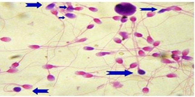 Figure 1: Appearance of spermatozoa in the vaginal swabs.