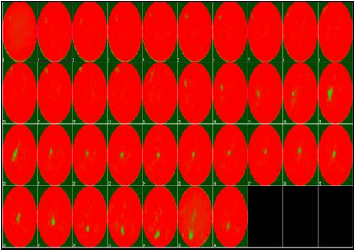 Figure 8: CT scans of core # EOR#02 after low pH Na2H2EDTA solution injection.