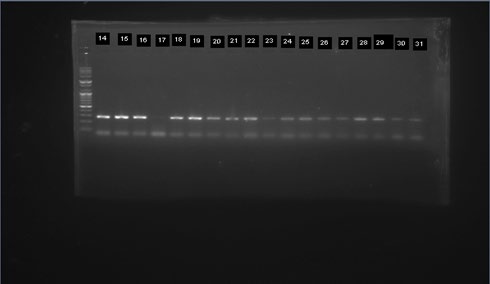 Figure 4: Gel electrophoregram for the identification of members Culex spp complex. Lane M=100bp molecular weight marker, Lane 1-31 at 274bps=Culex quenquifasciatus.