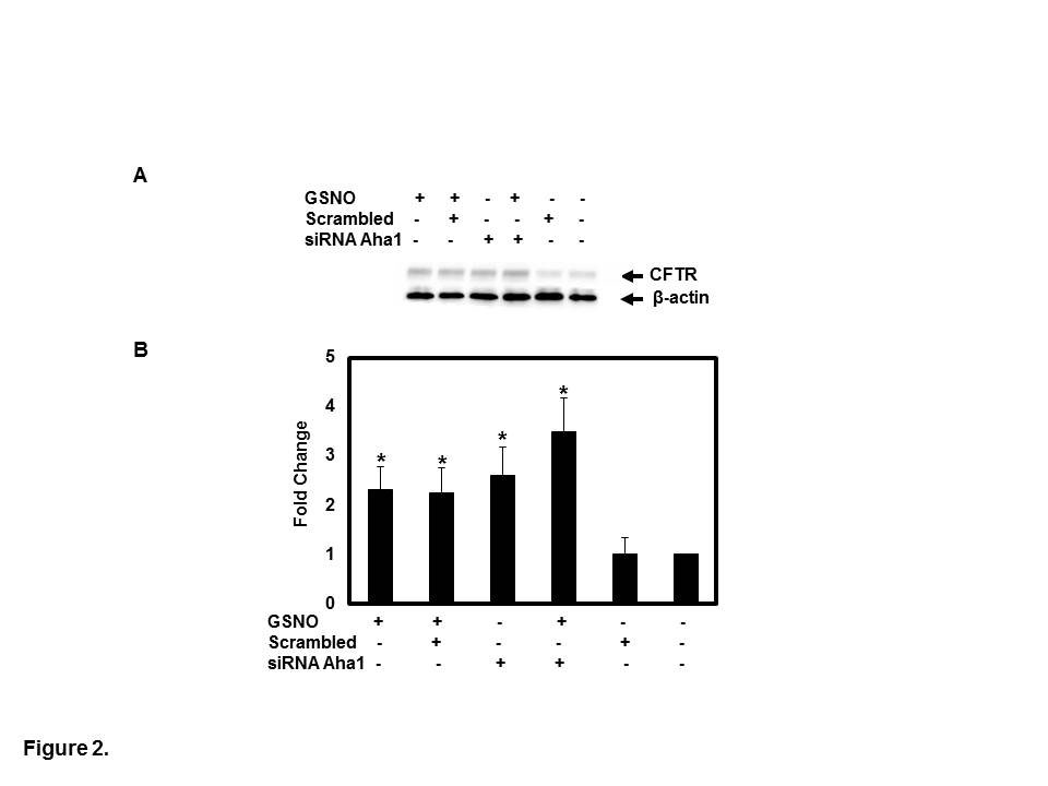 Figure 1: Aha1 is expressed in CFBE41o- cells expressing mutant F508del and wild type CFTR by Western blot using rabbit polyclonal anti-Aha1 antibody and 100 µg protein load (A). In the presence or absence of 10 µM GSNO for 4 h. We show 10 µM GSNO decreased the Aha1 expression levels in both mutant and wild type cells. Membranes were stripped and reprobed with β-actin. The optical densities of the bands were quantified by densitometry (B). Data are the mean ±SD, n=3, *p<0.01.
