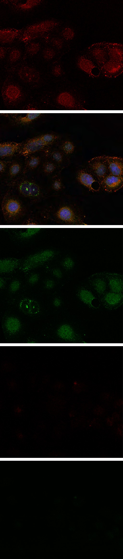 Figure 3: CFBE41o- cells were exposed to 5 and 10 µM GSNO for 4 hr. SNO proteins in whole cell lysates underwent biotin switch assay, followed by streptavidin purification and underwent immunoblot with anti-Aha1 antibody (A), as described previously [27]. The optical densities of the bands were quantified by densitometry (B). GSNO modification of Aha1 ATPase activity (C), was measured using the EnzChek phosphate detection kit. Wild type and F508del CFBE41o- were treated with 5 and 10 μM GSNO for 4 h and IP SNO-Aha1, then protein ATPase activity was measured in both conditions (C). Data are the mean ±SD, n=3, *p<0.01.