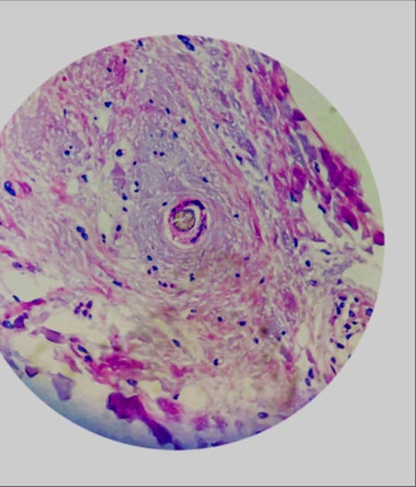 Figure 5: Naked hair follicles.