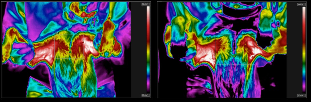 Figure 1: Examples of a pre-treatment (left) and post-treatment (right) analyzed FLIR image. The red triangle marks the high temperature in the boxed region.